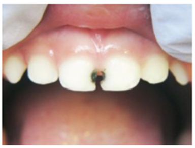 https://evolutiondentalcare.com.au/wp-content/uploads/2022/06/after.png