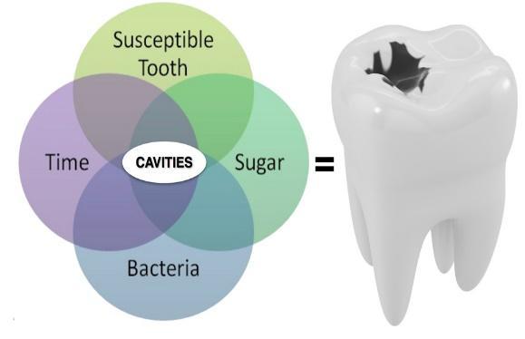 https://evolutiondentalcare.com.au/wp-content/uploads/2022/06/cavities.jpg