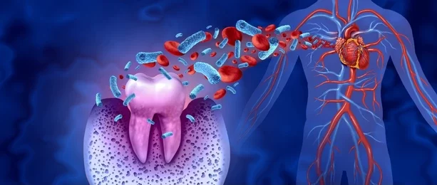 https://evolutiondentalcare.com.au/wp-content/uploads/2022/06/tooth-decay-heart-disease-unhealthy-260nw-2046503381-e1654527195904.webp